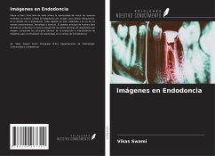 Imágenes en Endodoncia - Swami, Vikas