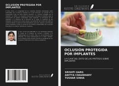 OCLUSIÓN PROTEGIDA POR IMPLANTES - Garg, Srishti; Chaudhary, Aditya; Sinha, Tushar