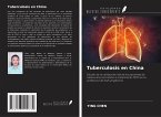 Tuberculosis en China