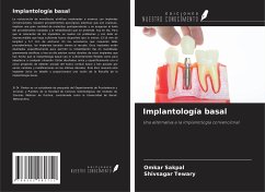 Implantología basal - Sakpal, Omkar; Tewary, Shivsagar