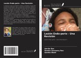 Lesión Endo-perio - Una Revisión