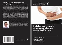 Fístulas pancreatico-colónicas múltiples, presentación rara - ElShaar, Khaled; Osman, Ahmed; AbuAleid, Laila