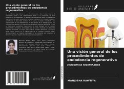 Una visión general de los procedimientos de endodoncia regenerativa - Rawtiya, Manjusha
