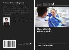 Queratocisto odontogénico - Furqhan Uddin, Syed