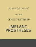 Implant retained Prostheses