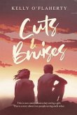 Cuts and Bruises (eBook, ePUB)