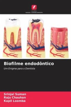 Biofilme endodôntico - Suman, Srinjal;Chauhan, Raju;Loomba, Kapil