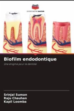 Biofilm endodontique - Suman, Srinjal;Chauhan, Raju;Loomba, Kapil