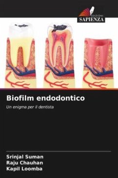 Biofilm endodontico - Suman, Srinjal;Chauhan, Raju;Loomba, Kapil