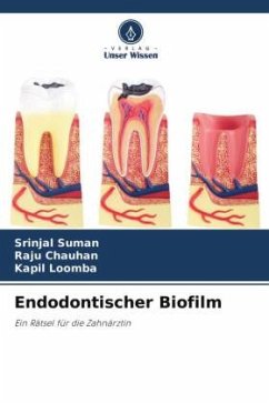 Endodontischer Biofilm - Suman, Srinjal;Chauhan, Raju;Loomba, Kapil
