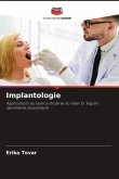 Implantologie