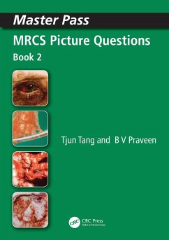 MRCS Picture Questions (eBook, PDF) - Tang, Tjun; Praveen, Bv