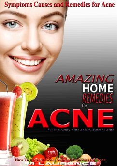 Amazing Home Remedies for Acne, Symptoms Causes and Remedies For Acne (eBook, ePUB) - Laurence, M.