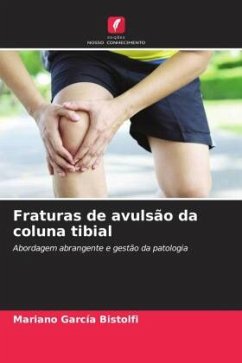 Fraturas de avulsão da coluna tibial - García Bistolfi, Mariano