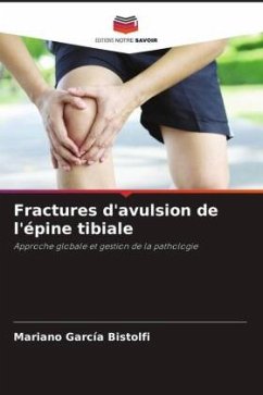 Fractures d'avulsion de l'épine tibiale - García Bistolfi, Mariano