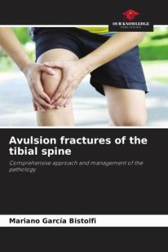 Avulsion fractures of the tibial spine - García Bistolfi, Mariano