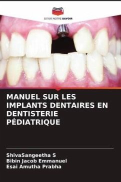 MANUEL SUR LES IMPLANTS DENTAIRES EN DENTISTERIE PÉDIATRIQUE - S, ShivaSangeetha;Emmanuel, Bibin Jacob;Prabha, Esai Amutha