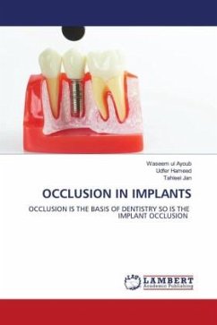 OCCLUSION IN IMPLANTS - Ul Ayoub, Waseem;Hameed, Udfer;Jan, Tahleel