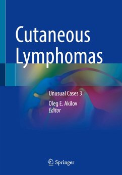 Cutaneous Lymphomas