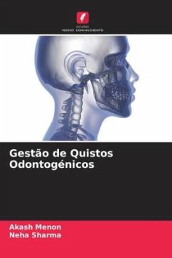 Gestão de Quistos Odontogénicos - Menon, Akash;Sharma, Neha