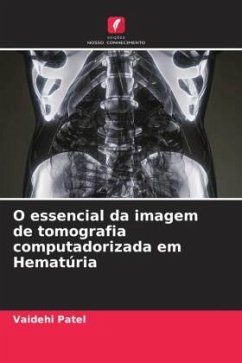 O essencial da imagem de tomografia computadorizada em Hematúria - Patel, Vaidehi