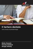 Il tartaro dentale