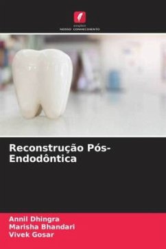 Reconstrução Pós-Endodôntica - Dhingra, Annil;Bhandari, Marisha;Gosar, Vivek