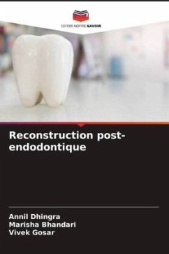 Reconstruction post-endodontique - Dhingra, Annil;Bhandari, Marisha;Gosar, Vivek