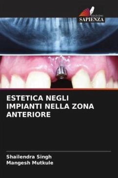 ESTETICA NEGLI IMPIANTI NELLA ZONA ANTERIORE - Singh, Shailendra;Mutkule, Mangesh