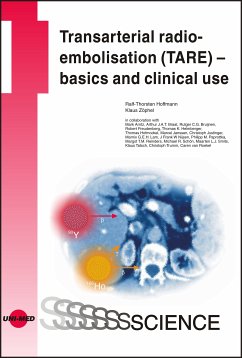 Transarterial radioembolisation (TARE) – basics and clinical use (eBook, PDF) - Hoffmann, Ralf-Thorsten; Zöphel, Klaus