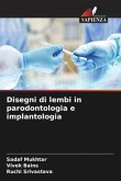 Disegni di lembi in parodontologia e implantologia