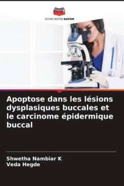 Apoptose dans les lésions dysplasiques buccales et le carcinome épidermique buccal - Nambiar K, Shwetha;Hegde, Veda