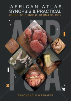 African Atlas, Synopsis & Practical Guide to Clinical Dermatology - Makhakhe, Lehlohonolo