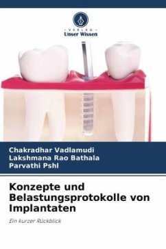 Konzepte und Belastungsprotokolle von Implantaten - Vadlamudi, Chakradhar;Bathala, Lakshmana Rao;PSHL, Parvathi