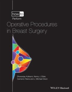 How to Perform Operative Procedures in Breast Surgery - Kulkarni, Dhananjay; Elder, Kenneth J.; Raine, Cameron