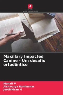 Maxillary Impacted Canine - Um desafio ortodôntico - V, Munaif;Ramkumar, Aishwarya;H, Jyothikiran