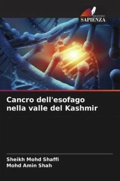 Cancro dell'esofago nella valle del Kashmir - Shaffi, Sheikh Mohd;Shah, Mohd Amin