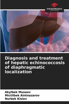 Diagnosis and treatment of hepatic echinococcosis of diaphragmatic localization - Musaev, Akylbek;Aintnazarov, Mictilbek;Kisiev, Nurbek