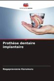 Prothèse dentaire implantaire