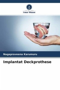 Implantat Deckprothese - Karumuru, Nagapraveena