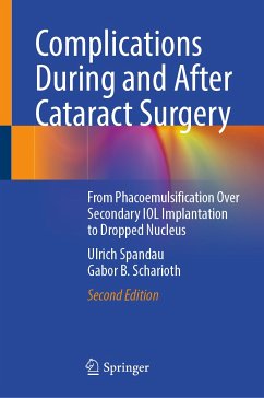 Complications During and After Cataract Surgery (eBook, PDF) - Spandau, Ulrich; Scharioth, Gabor B.