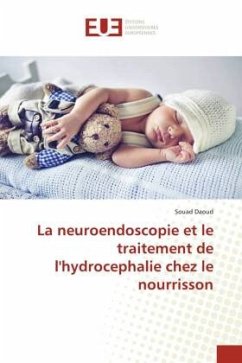 La neuroendoscopie et le traitement de l'hydrocephalie chez le nourrisson - Daoud, Souad