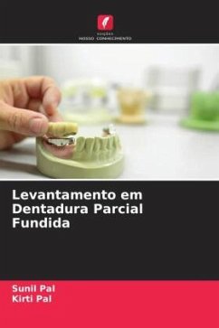 Levantamento em Dentadura Parcial Fundida - Pal, Sunil;Pal, Kirti