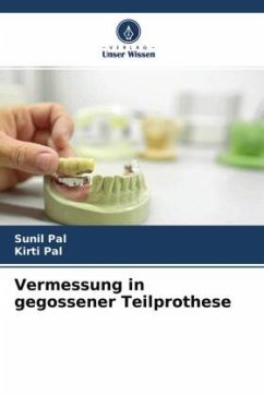 Vermessung in gegossener Teilprothese - Pal, Sunil;Pal, Kirti