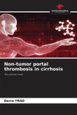 Non-tumor portal thrombosis in cirrhosis