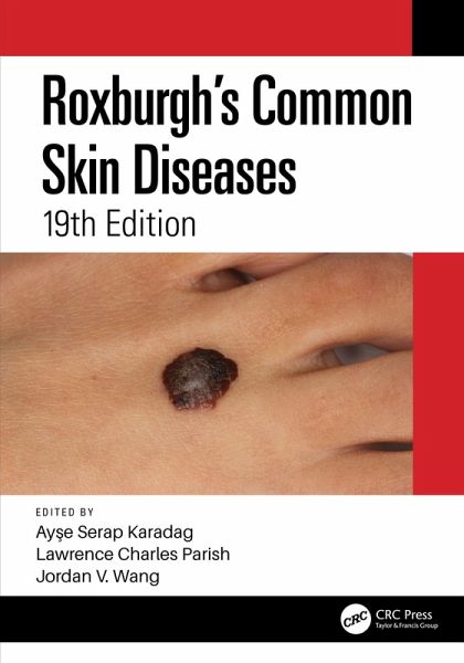 Roxburgh's Common Skin Diseases (eBook, ePUB) Roxburgh's Common Skin Diseases (eBook, ePUB)