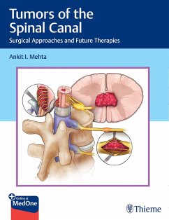 Tumors of the Spinal Canal (eBook, PDF) - Mehta, Ankit I.
