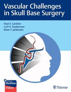 Vascular Challenges in Skull Base Surgery (eBook, PDF) - Gardner, Paul; Snyderman, Carl; Jankowitz, Brian