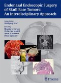 Endonasal Endoscopic Surgery of Skull Base Tumors: An Interdisciplinary Approach (eBook, PDF)