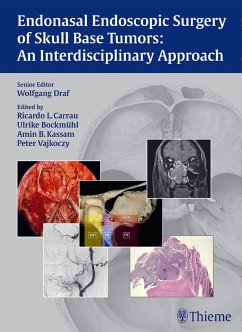 Endonasal Endoscopic Surgery of Skull Base Tumors: An Interdisciplinary Approach (eBook, PDF) - Draf, Wolfgang; Carrau, Ricardo L.; Bockmühl, Ulrike; Kassam, Amin B.; Vajkoczy, Peter